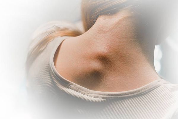 Prevenzione alle deviazioni e ai disturbi del Rachide