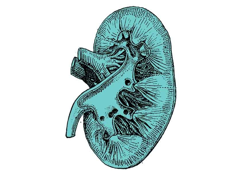 Terapia classica e naturale per Calcolosi Urinaria