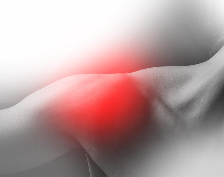 Trattamento della spalla congelata