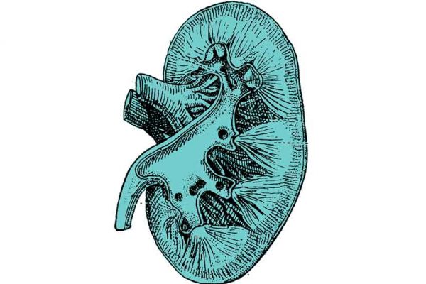 Terapia classica e naturale per Calcolosi Urinaria