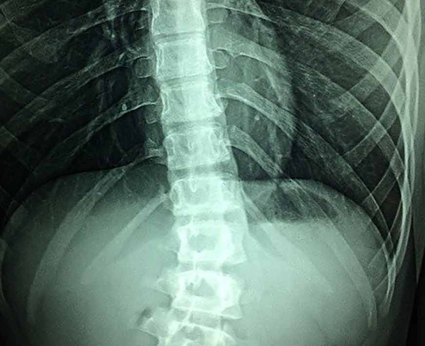 cosa cura la osteopatia