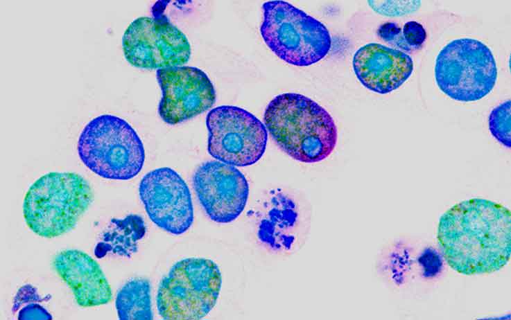 Potenziamento dell'immunocompetenza