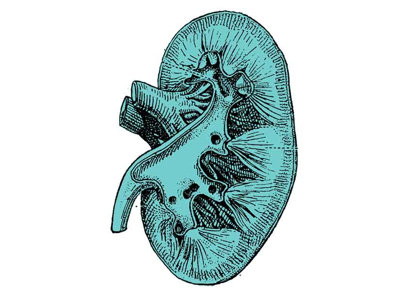 Terapia classica e naturale per Calcolosi Urinaria
