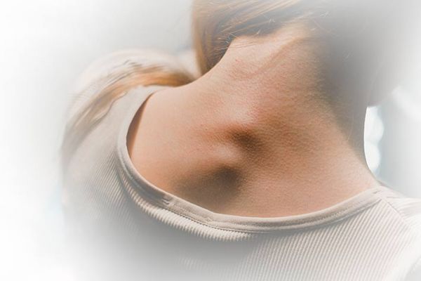 Prevenzione alle deviazioni e ai disturbi del Rachide