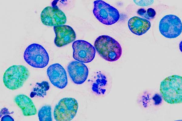 Potenziamento dell'immunocompetenza