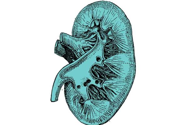 Terapia classica e naturale per Calcolosi Urinaria